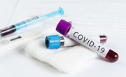 Вчені НУБіП розробили і готові випускати тест-системи на коронавірус